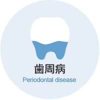 歯周病